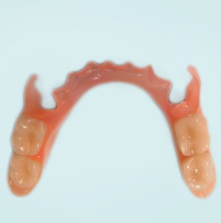 Dentures - a comprehensive guide for patients in Oakville - Bronte Road ...