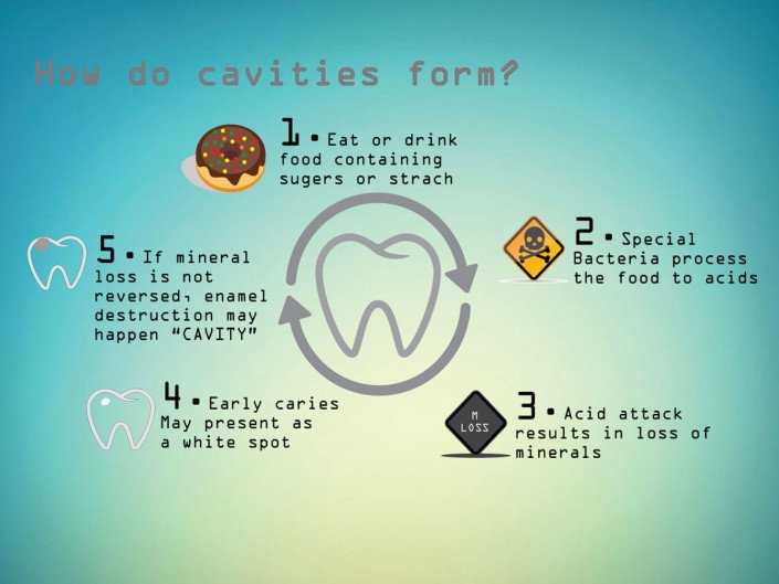 How do cavities form? - Bronte Road Family Dental